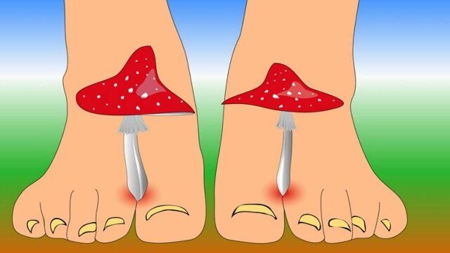 ��������� ��������: ��� ����� ����� � ��������, ��������� � ������� �������