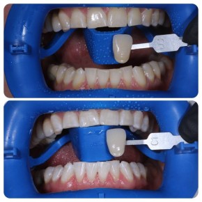 ��� ������� ��������� �� ������ � �������