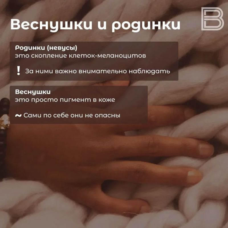 Веснушки летом: скрывать, оставить или нарисовать? Веснушки летом: скрывать, оставить или нарисовать?