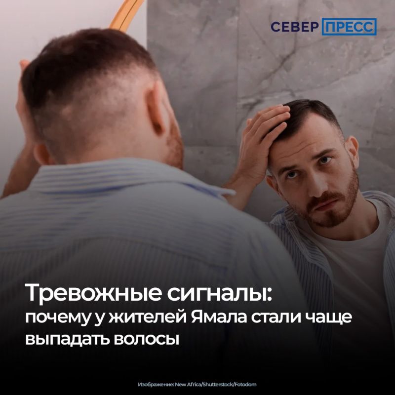 За последние годы на Ямале увеличилось число людей, которые сталкиваются с проблемой выпадения волос