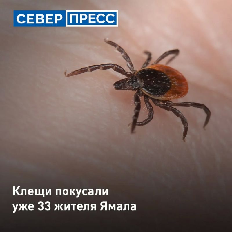 С начала 2026 года на Ямале зафиксировано 33 случая укусов клещей, все они являются «завозными»